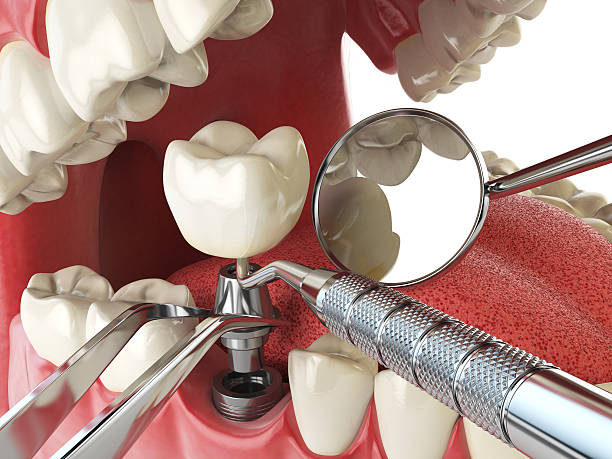 Best Weekend Emergency Dentist in Oconto Falls, WI