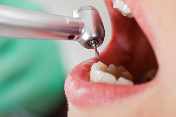 Best Emergency Cosmetic Dentistry in Oconto Falls, WI